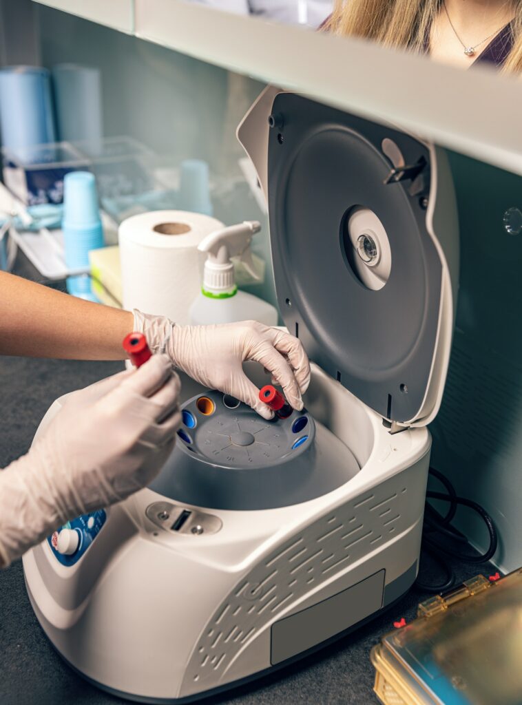 Blood samples tested in the laboratory